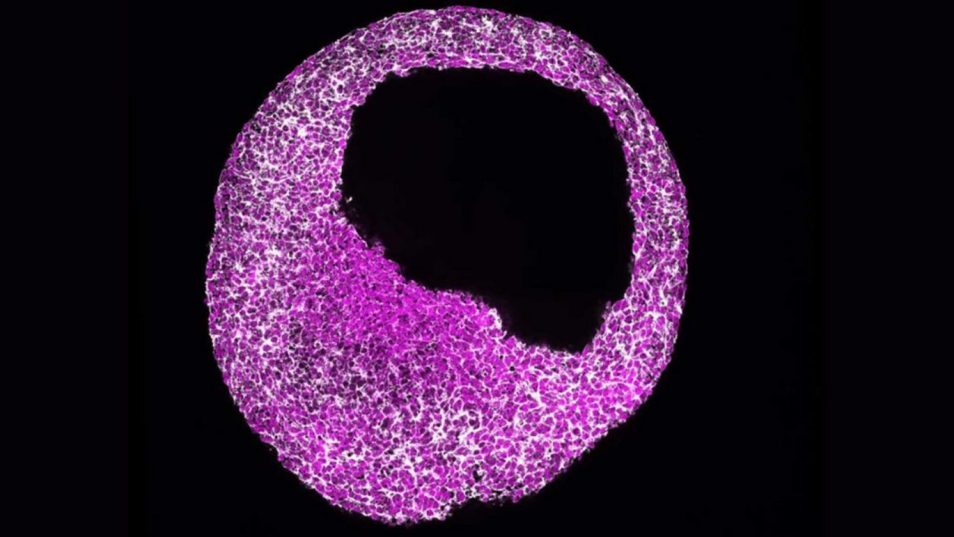 A human cardiac organoid (Cardioid), one of the models the researchers used to reconstruct human cardiac development in 3D. Cardiac mesoderm stage human Cardioid visualizing Phalloidin (grey) and β-catenin (Magenta).